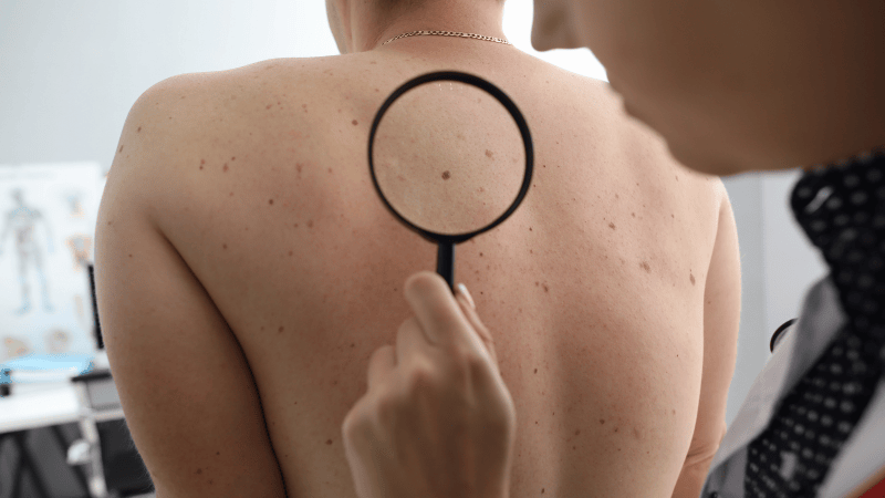 Dermatology