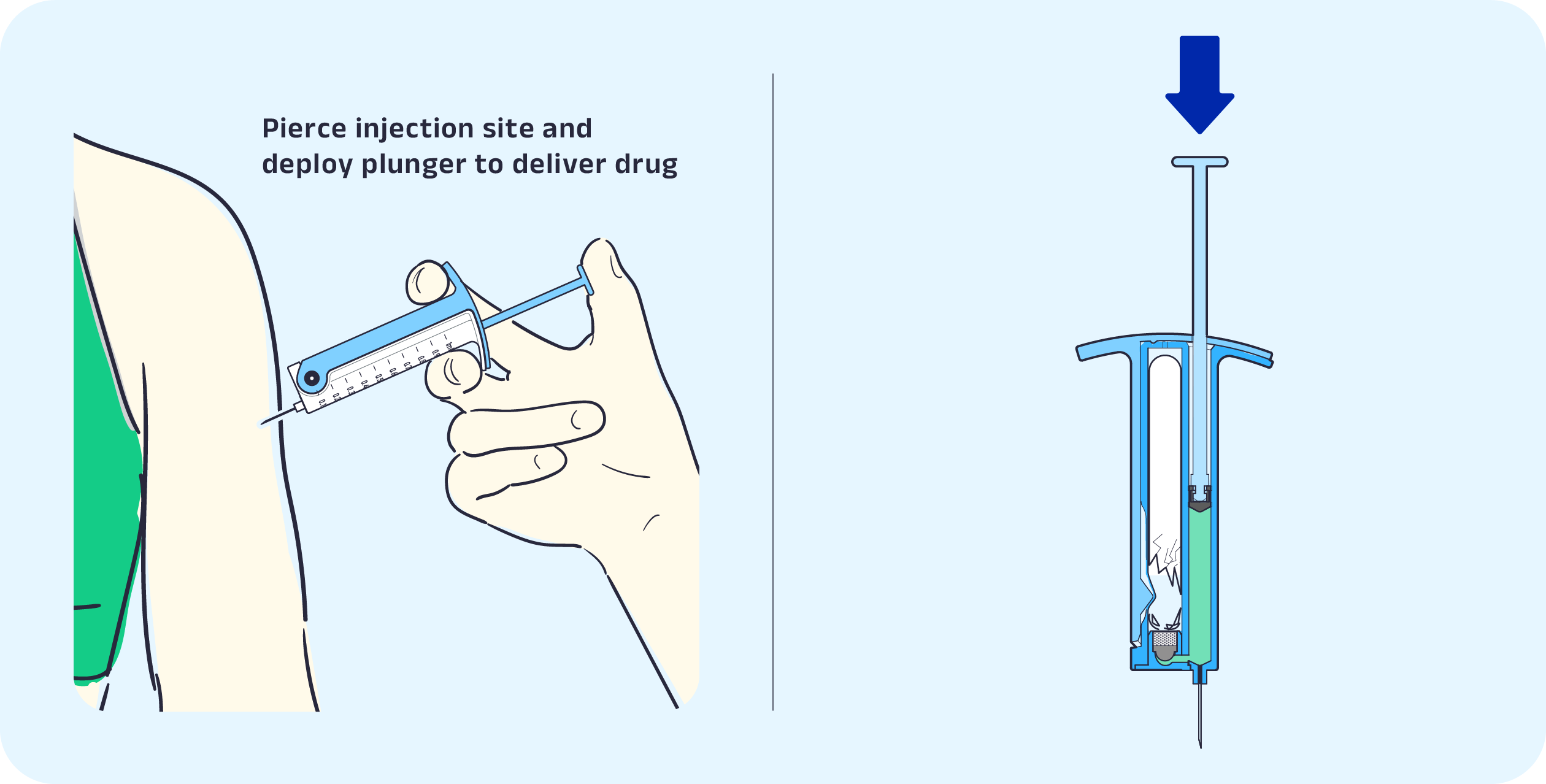 Step4-blue@3x